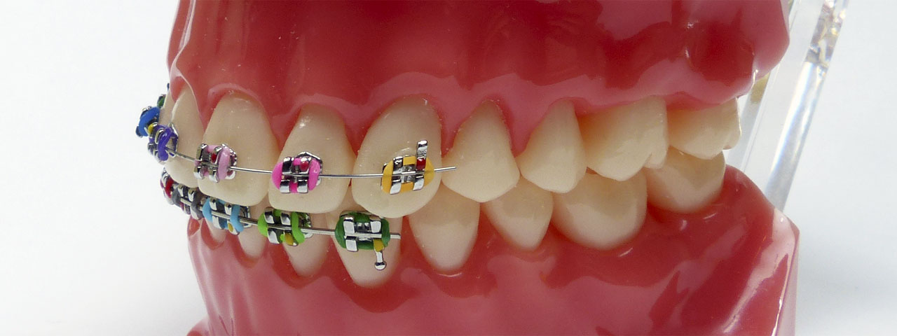 Slide 4